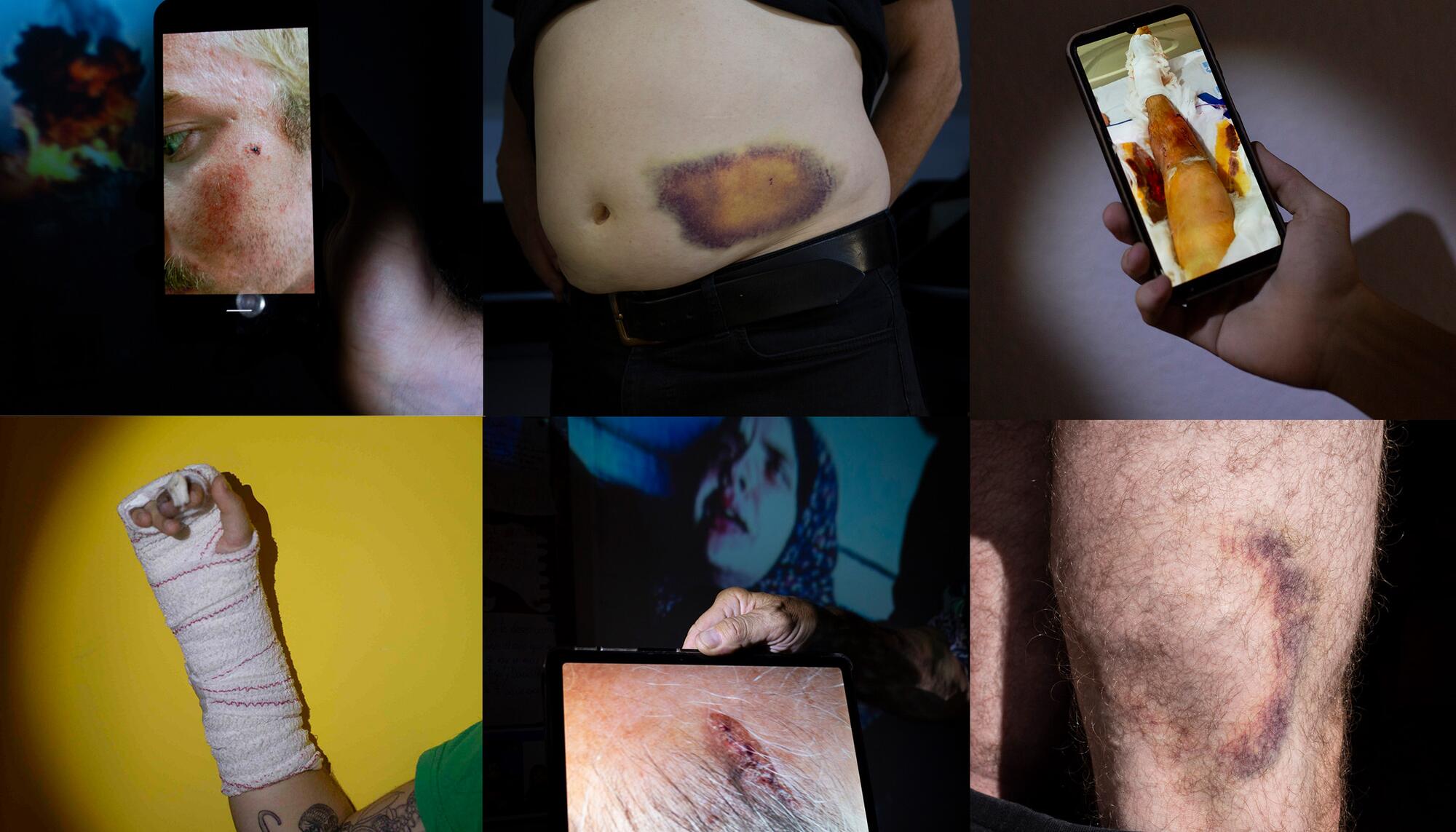 Mosaico Agresiones Policiales Vuelta Ciclista
