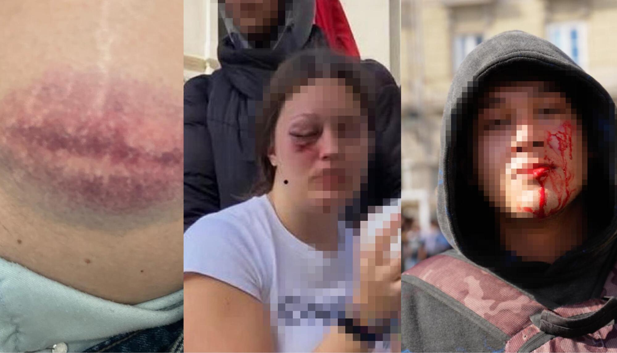 jovenes heridos a coruña