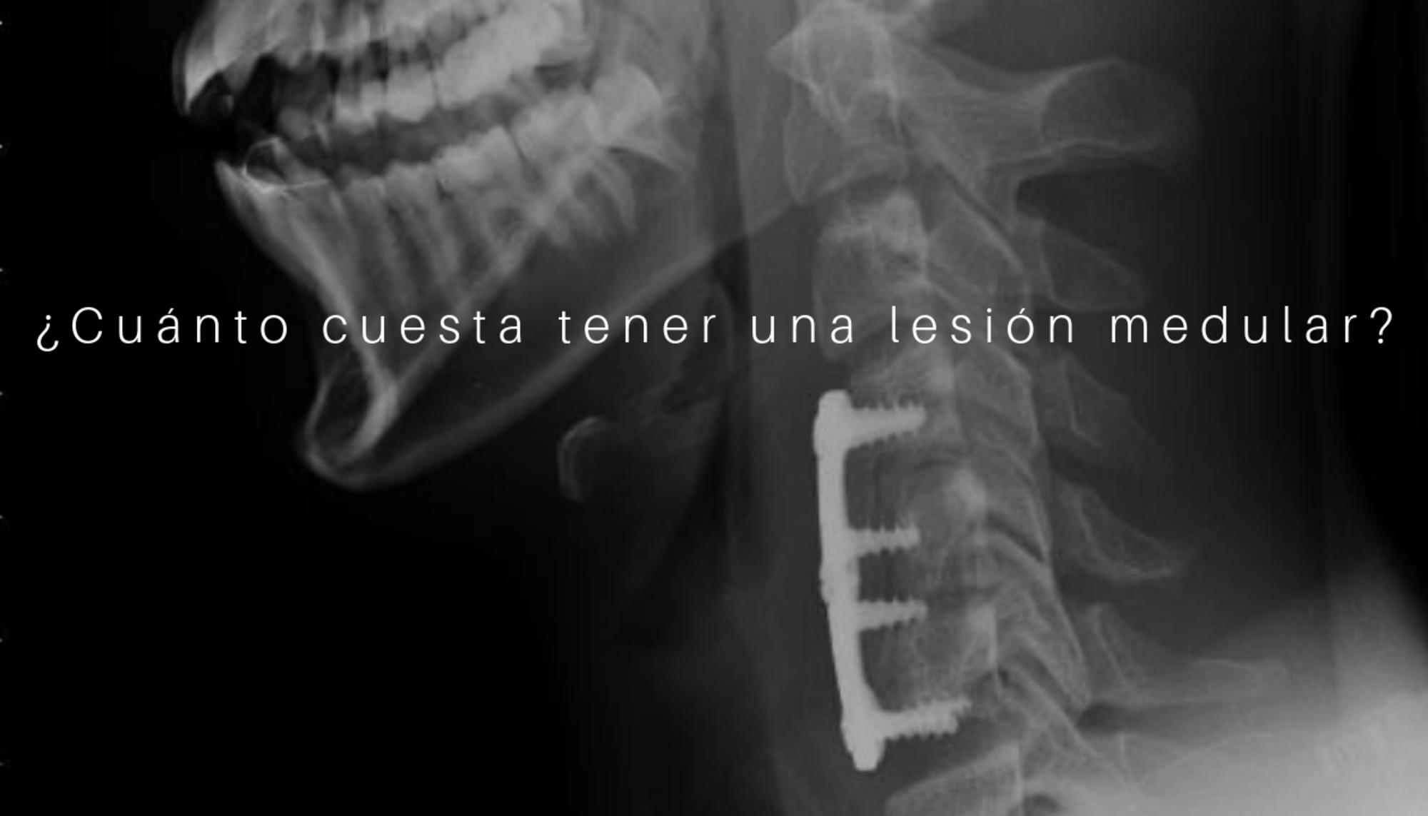 Portada cuanto cuesta lesión medular