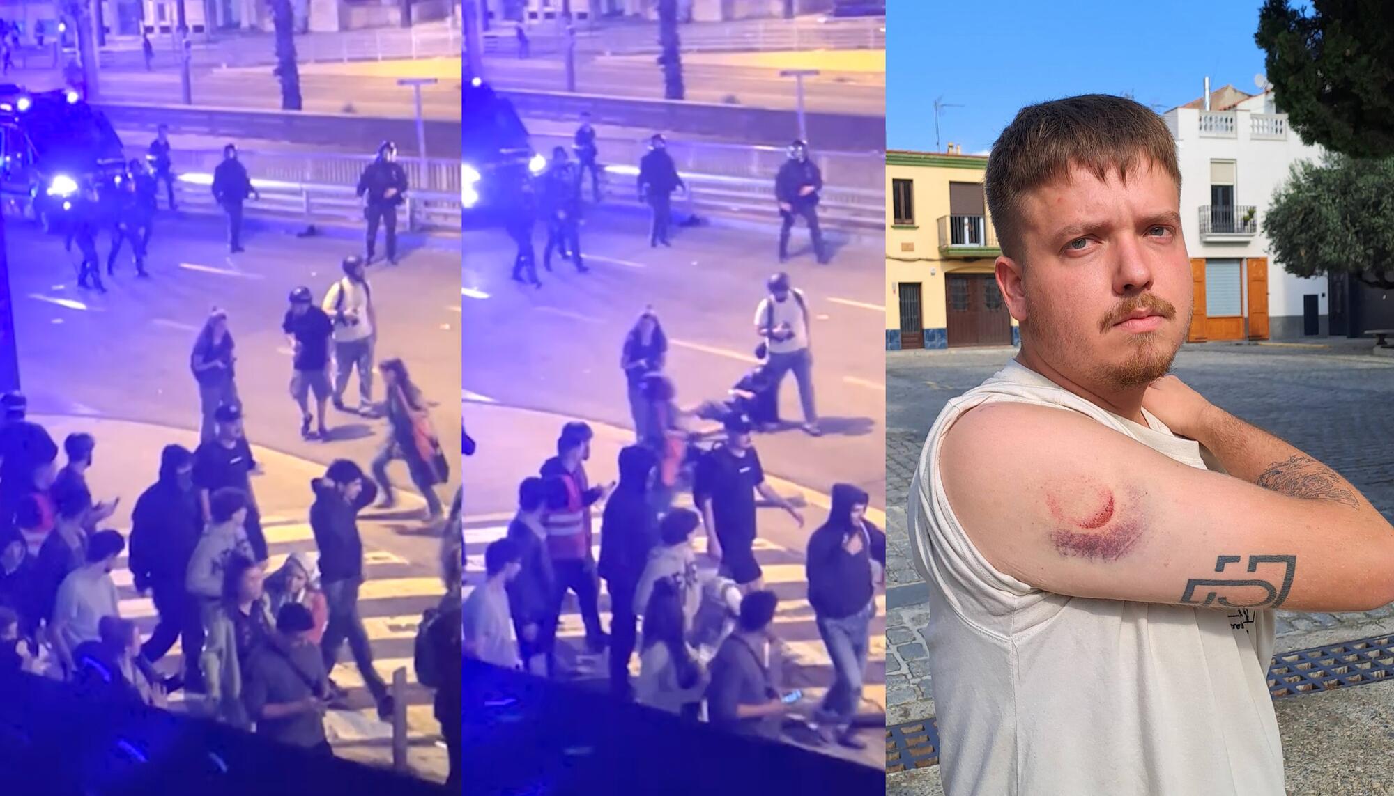 Joan Galvez Herido bala Foam