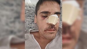 El periodista Fonsi Loaiza sufre una brutal agresión en la calle en Cádiz