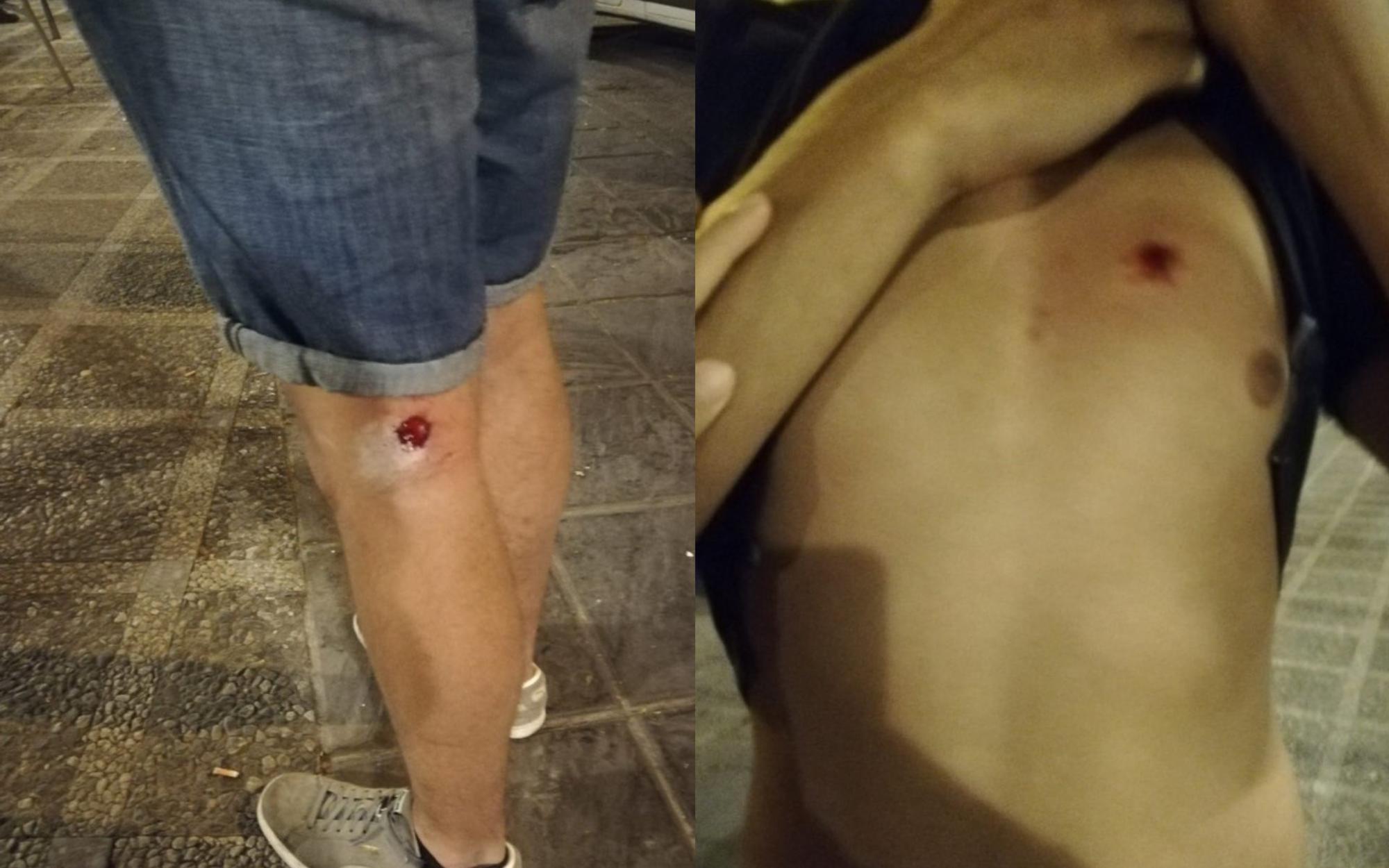 Granada -pablo violencia policial