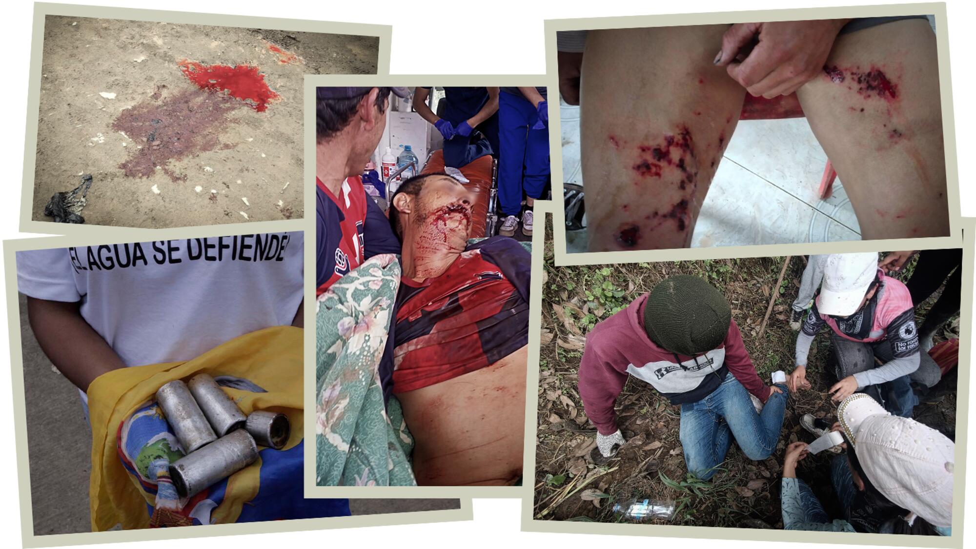 Campesinos heridos tras la militarización de Palo Quemado. / FNA.