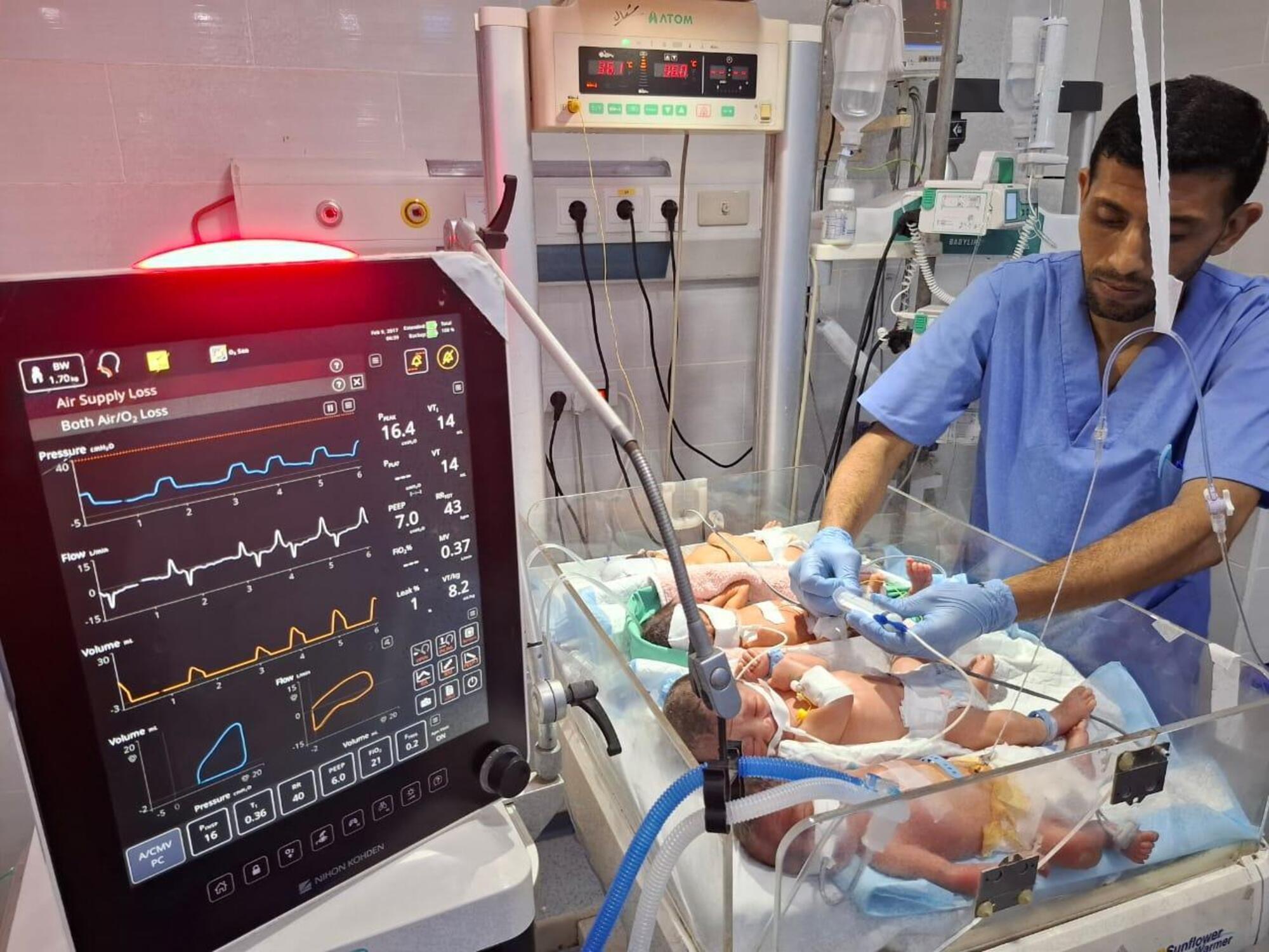 Malnutrición Gaza
