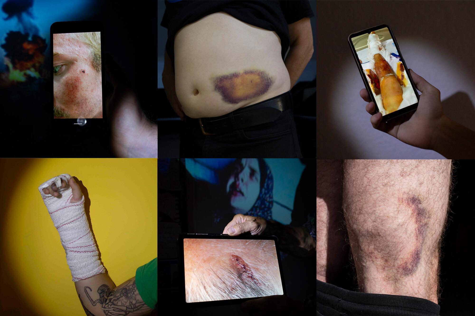 Mosaico Agresiones Policiales Vuelta Ciclista