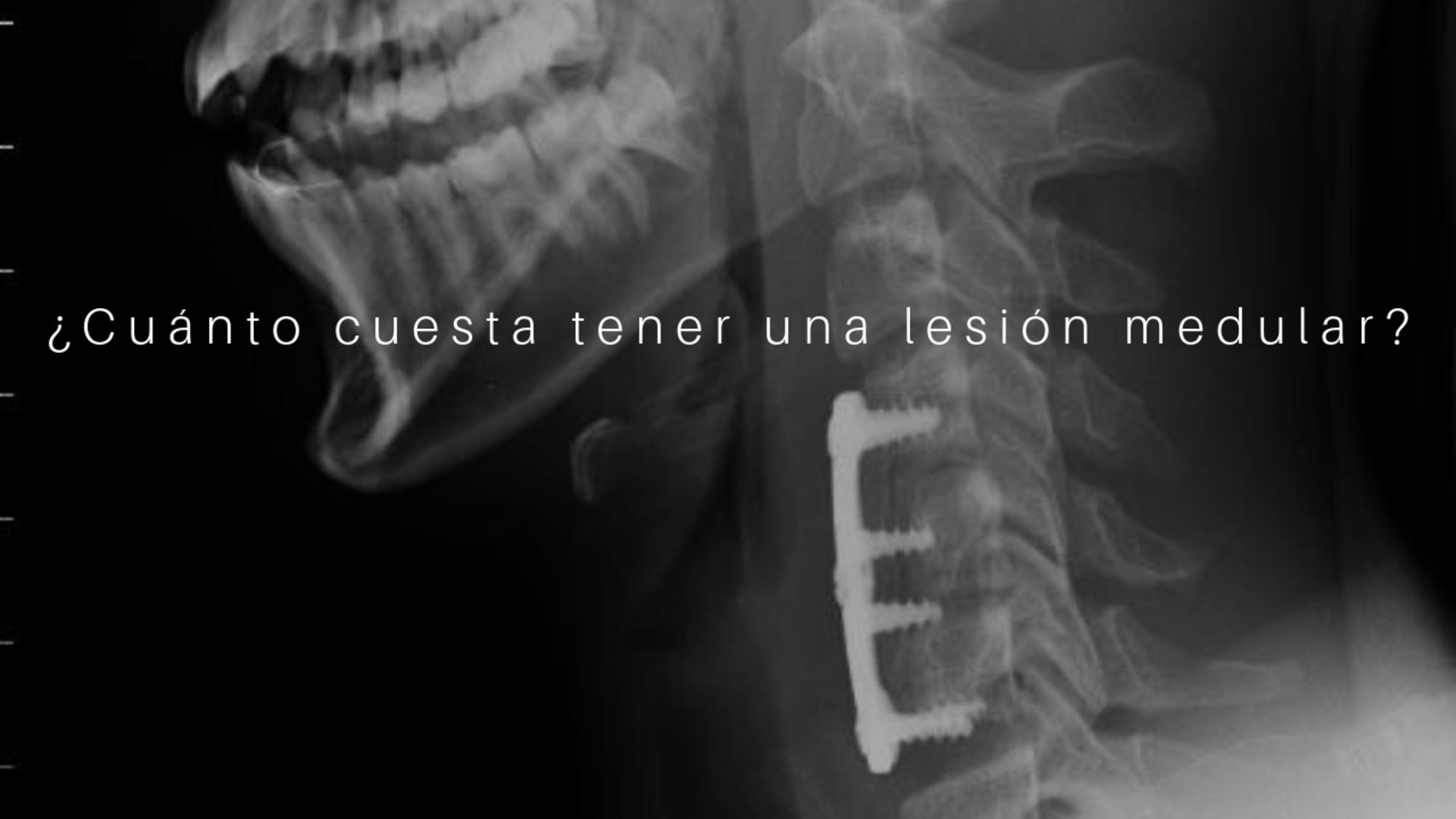 Portada cuanto cuesta lesión medular
