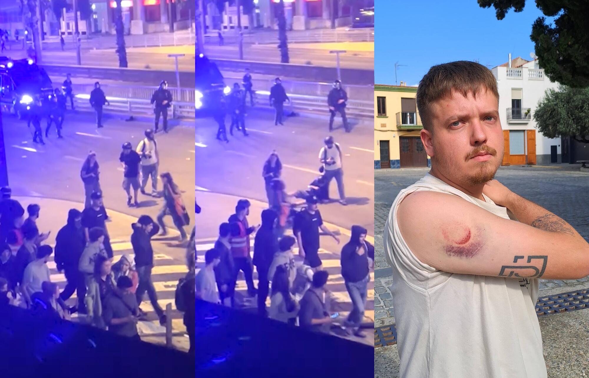 Joan Galvez Herido bala Foam