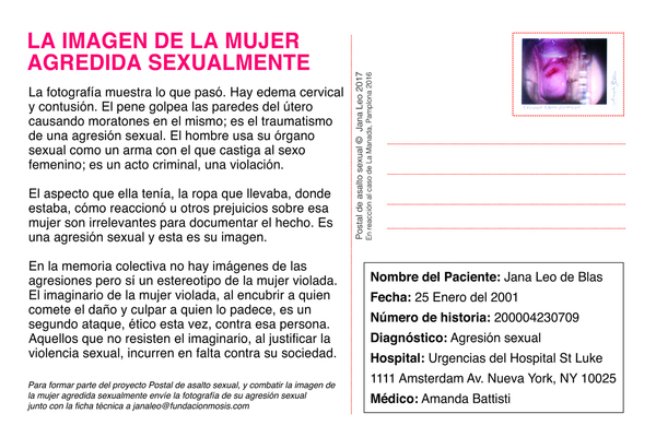 Postal Asalto Sexual Jana Leo