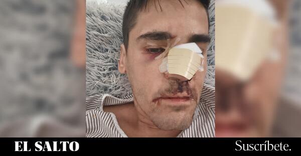 El periodista Fonsi Loaiza sufre una brutal agresión en la calle en Cádiz